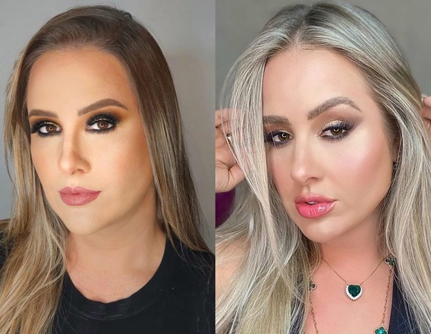 Patricia Leitte antes e depois da harmonização facial (Foto: Reprodução/Instagram)