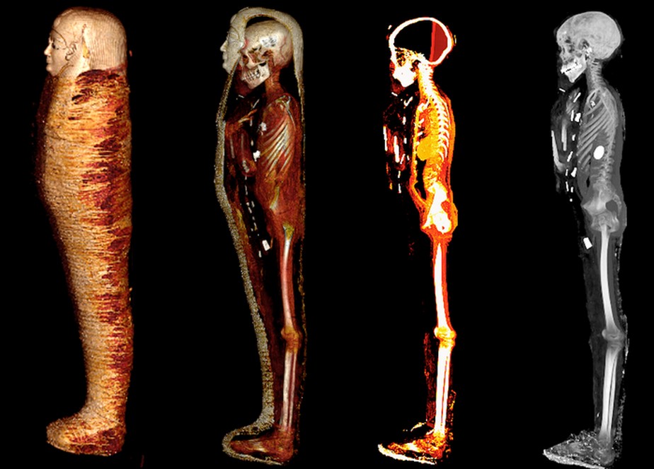Resultados da tomografia em quatro etapas da múmia