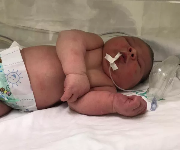 Bebe Nasce Com Mais De 5 Kg Em Cascavel E Surpreende A Familia Nasceu Criado Oeste E Sudoeste G1