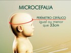 Abrigo do Recife acolhe bebê abandonado portador de microcefalia