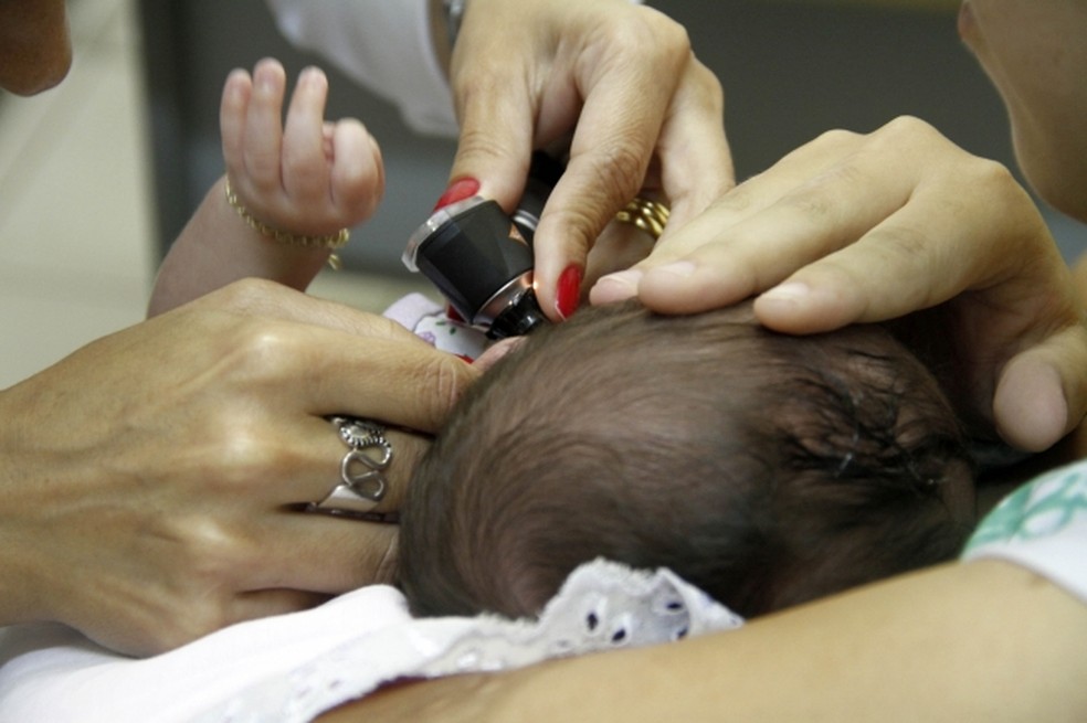 Em MT foram notificados 427 casos de 2015 até novembro de 2019 de microcefalia — Foto: Divulgação/SES