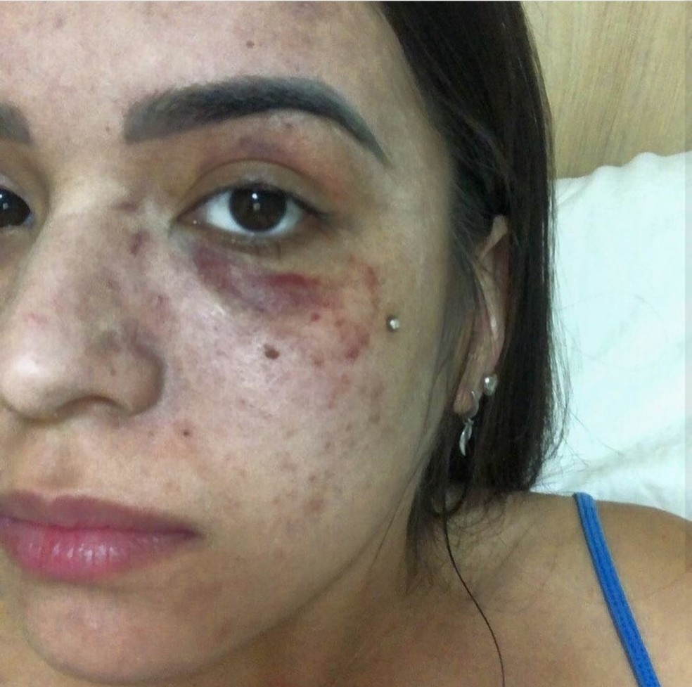 Ana Clara de Souza Arante, de 23 anos,  vítima de violência doméstica — Foto: arquivo pessoal