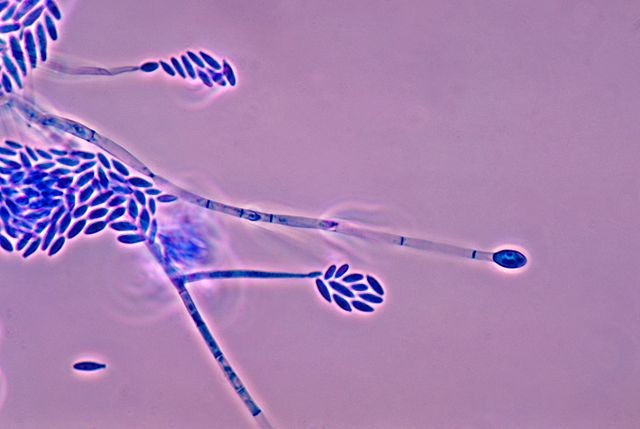 Conidióforos e conídias do fungo Fusarium verticillioides (Foto: Wikimedia Commons)