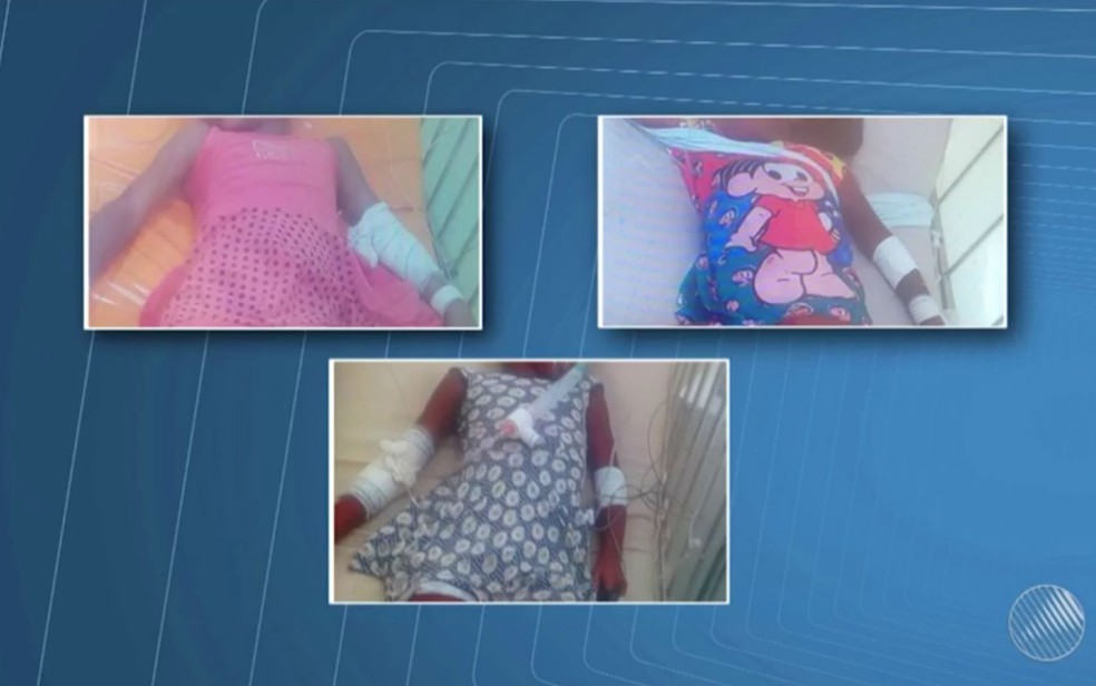 Meninas foram internadas após ingerirem medicamento controlado na Bahia (Foto: Reprodução/TV Santa Cruz)