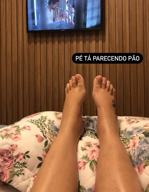Cantora sertaneja Maria Cecília, da dupla com o marido Rodolfo, mostra pés inchados (Foto: Reprodução/Instagram)