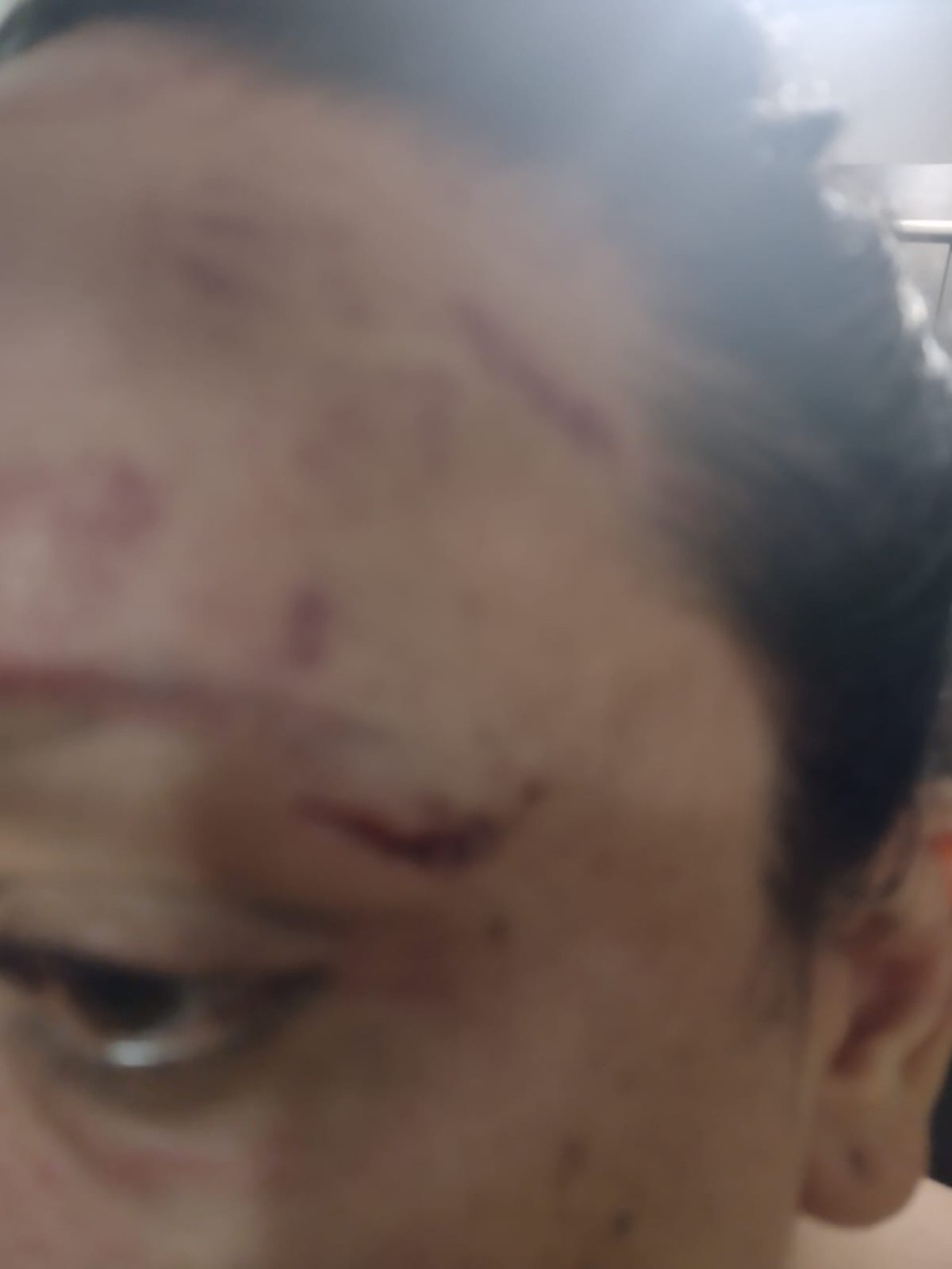 Mulher trans relata ter sido agredida após defender amiga vítima de transfobia em Americana - Globo.com