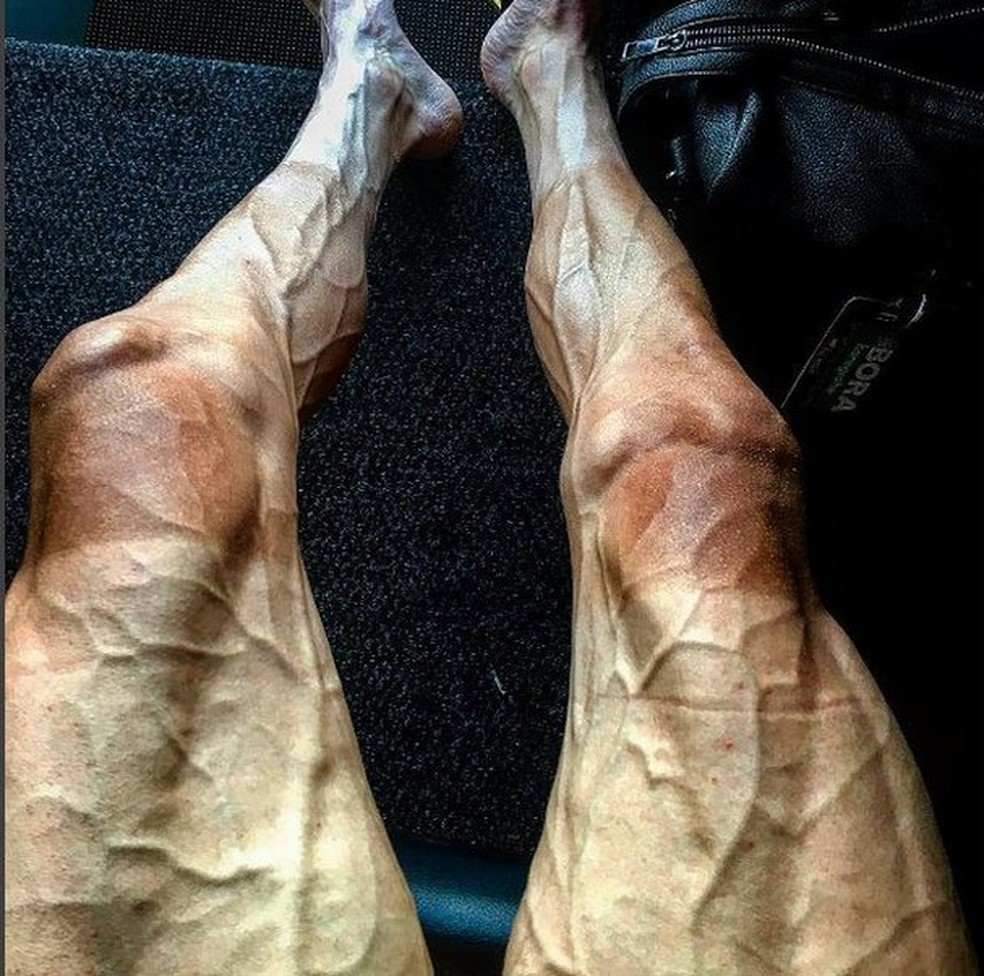 Inchadas e com queimaduras de sol, as pernas de Poljanski não são uma propaganda saudável do ciclismo (Foto: Instagram/Pawel Poljanski)