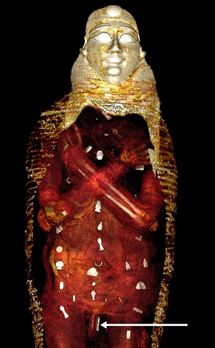 Os amuletos foram dispostas sobre e dentro da múmia em três colunas — Foto: Divulgação/SN Saleem, SA Seddik, M el-Halwagy