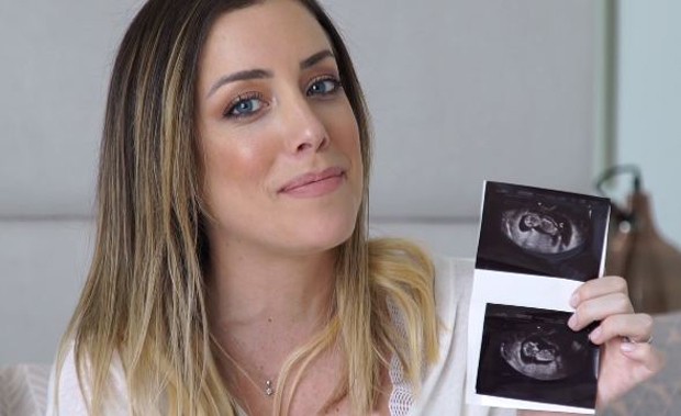 Fabiana Justus exibindo orgulhosa o ultrasom de suas gêmeas (Foto: Reprodução/Youtube)