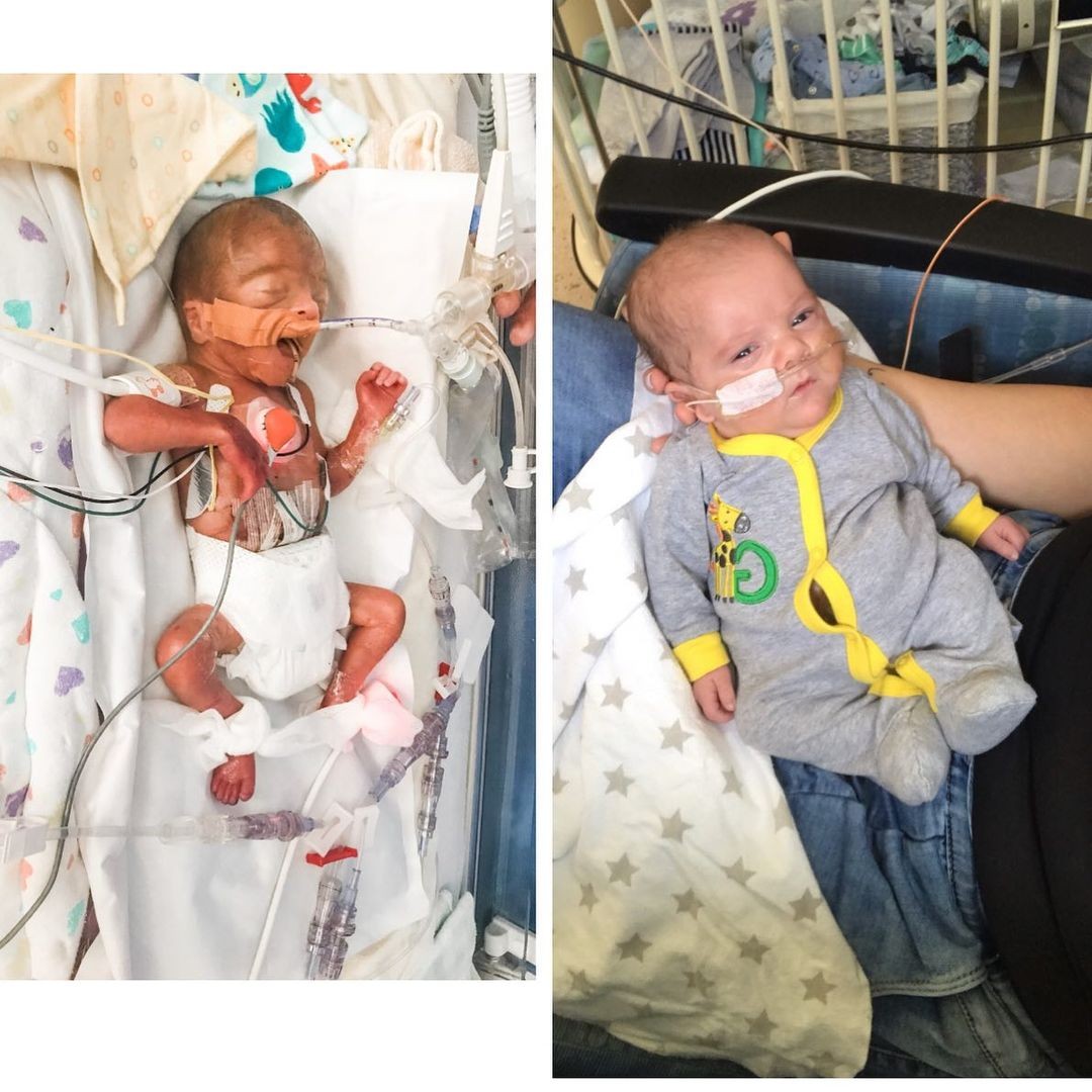 Menino que nasceu com 23 semanas sobreviveu, apesar das estatísticas (Foto: Reprodução/Instagram)