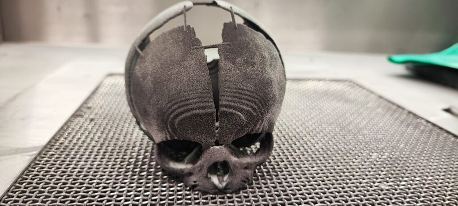 Crânio impresso em 3D: técnica inovadora auxilia médicos em cirurgia arriscada em recém-nascido.