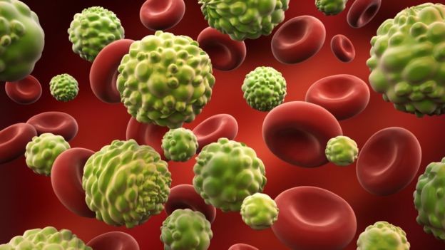 Celular tumorais passam para outras partes do corpo por meio da corrente sanguínea (Foto: Getty Images via BBC News)
