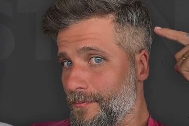 Bruno Gagliasso comenta decisão de fazer novo transplante capilar