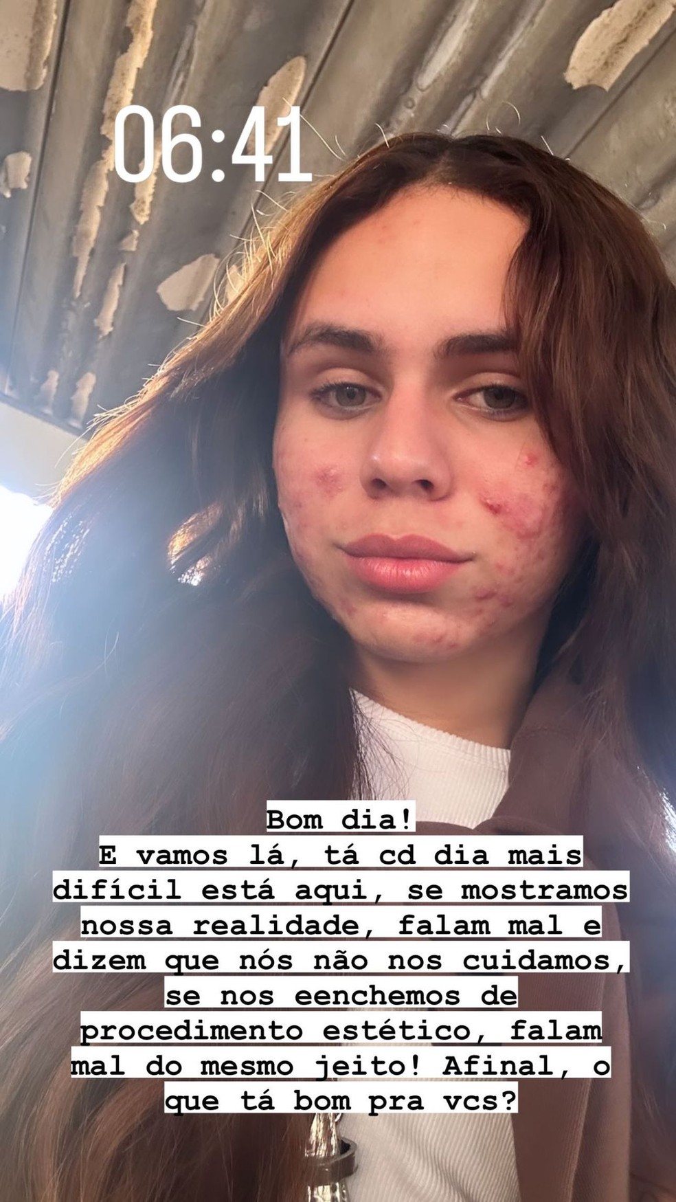 Influenciadora Alexia Brito mostra "pela real" &mdash; Foto: reprodu&ccedil;&atilde;o/ instagram 