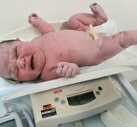 Bebê nasceu com mais de 5 kg e surpreendeu a mãe (Foto: Reprodução/Daily Mail/Mercury Press & Media)