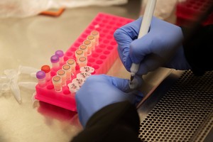 Pesquisadores do Instituto de Pesquisa em Microbiologia da Universidade de Minnesota, nos EUA, estudam medicamento para Covid-19