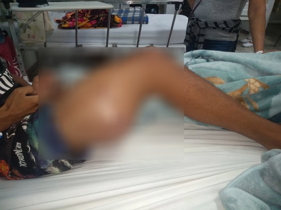 Mike tinha tumor na coxa e aguardou por um mÃªs transferÃªncia para uma unidade de saÃºde especializada â Foto: Arquivo Pessoal