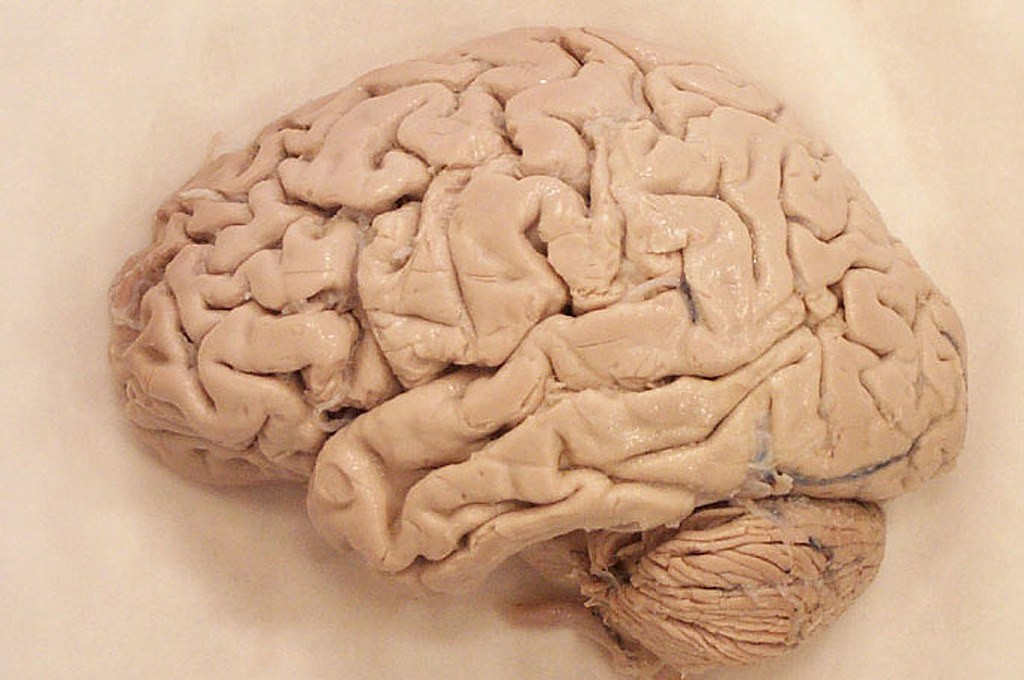 Cérebro humano não diminuiu há 3 mil anos, segundo novo estudo  (Foto: Flickr/Creative Commons )