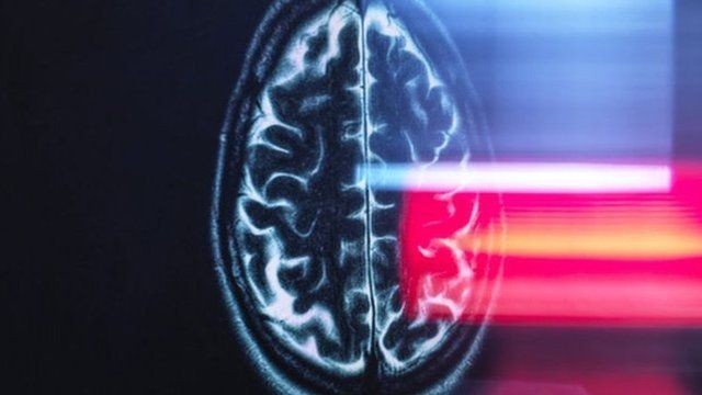 Hoje, ainda se sabe mais sobre a mente do que sobre o cérebro (Foto: Getty Images via BBC)