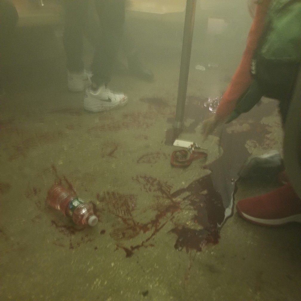 Sangue é visto em estação de metrô após tiroteio, em Nova York, nesta terça-feira (12) — Foto: Armen Armenian/via Reuters