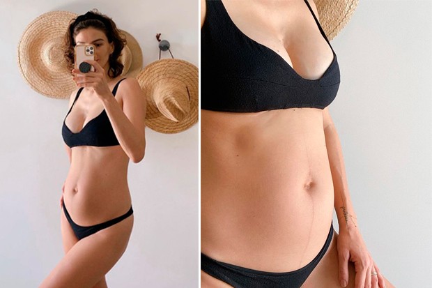 Mônica Benini mostra corpo no pós-parto (Foto: Reprodução/Instagram)