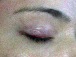 Vítima diz que sofria agressões constantes no rosto e na cabeça pelo ex-namorado, sargento do Exército (Foto: Divulgação/ Arquivo pessoal)