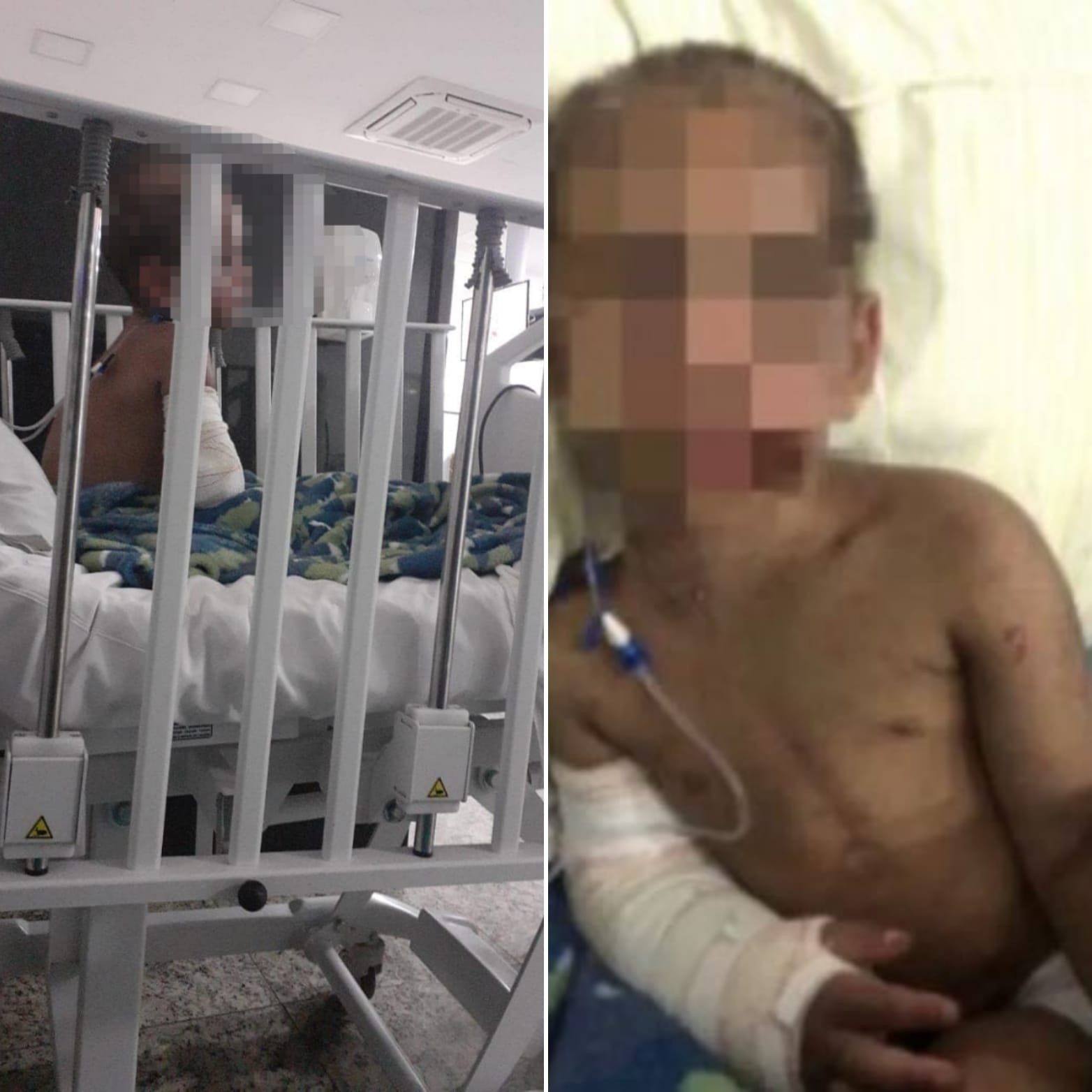 Criança que teve oito costelas e braço quebrados pela própria mãe precisou ser reanimada em hospital em SP: 'Vi ele morto'
