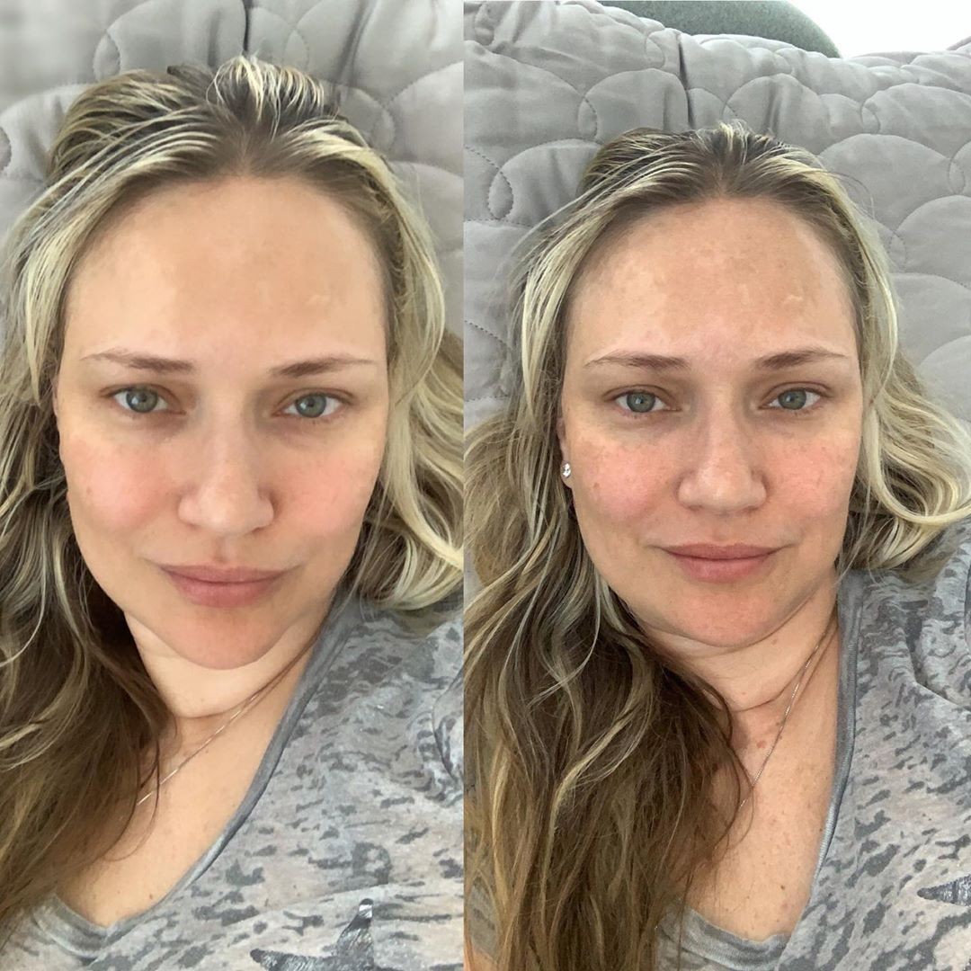 Fabiana Saba mostra antes e depois nas redes sociais (Foto: Reprodução/Instagram)