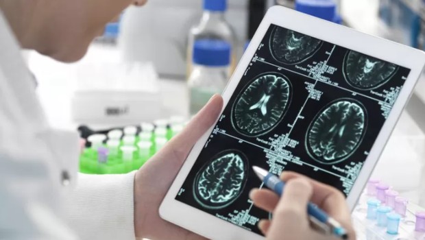 Estudos científicos mostraram alterações no cérebro em exames de imagem de pacientes que tiveram covid (Foto: Getty Images viaBBC)