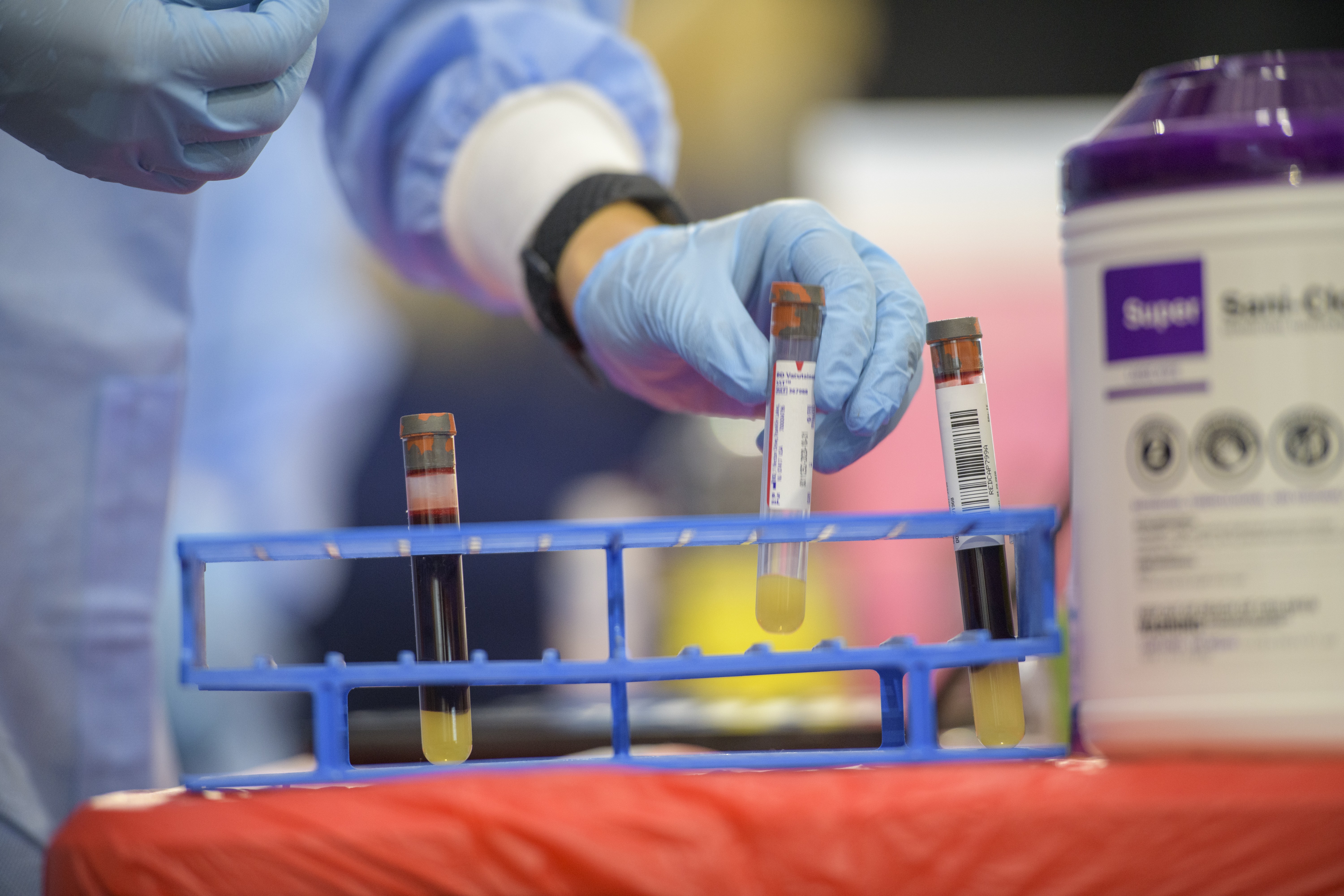 tubo, ciência, cientista, teste, sangue, exame, anticorpos (Foto: University of Arizona Health Sciences, Kris Hanning)
