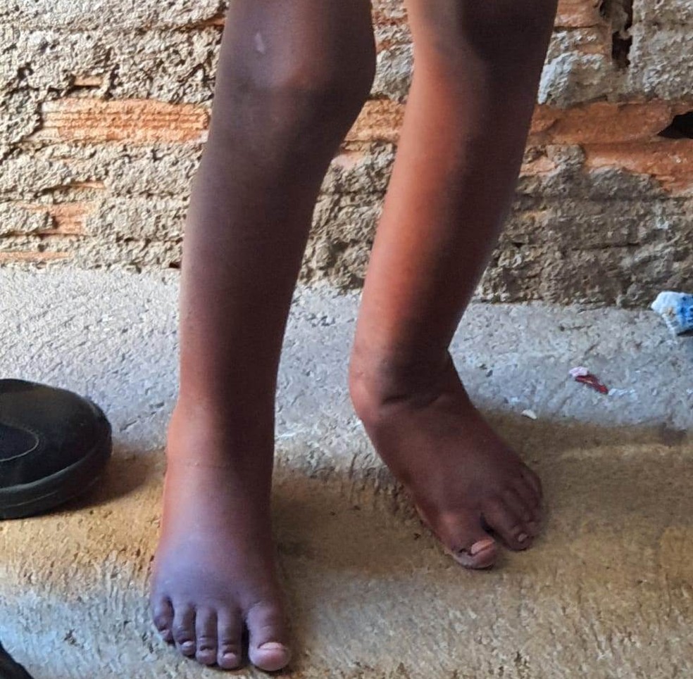 Criança foi resgatada após sofrer tortura em Campinas, diz PM — Foto: Polícia Militar