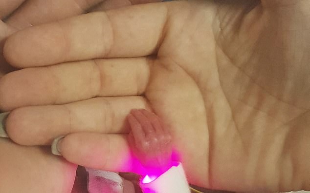 A mãozinha de Isabella que nasceu pesando com cerca de 340 gramas (Foto: Reprodução/Daily Mail)