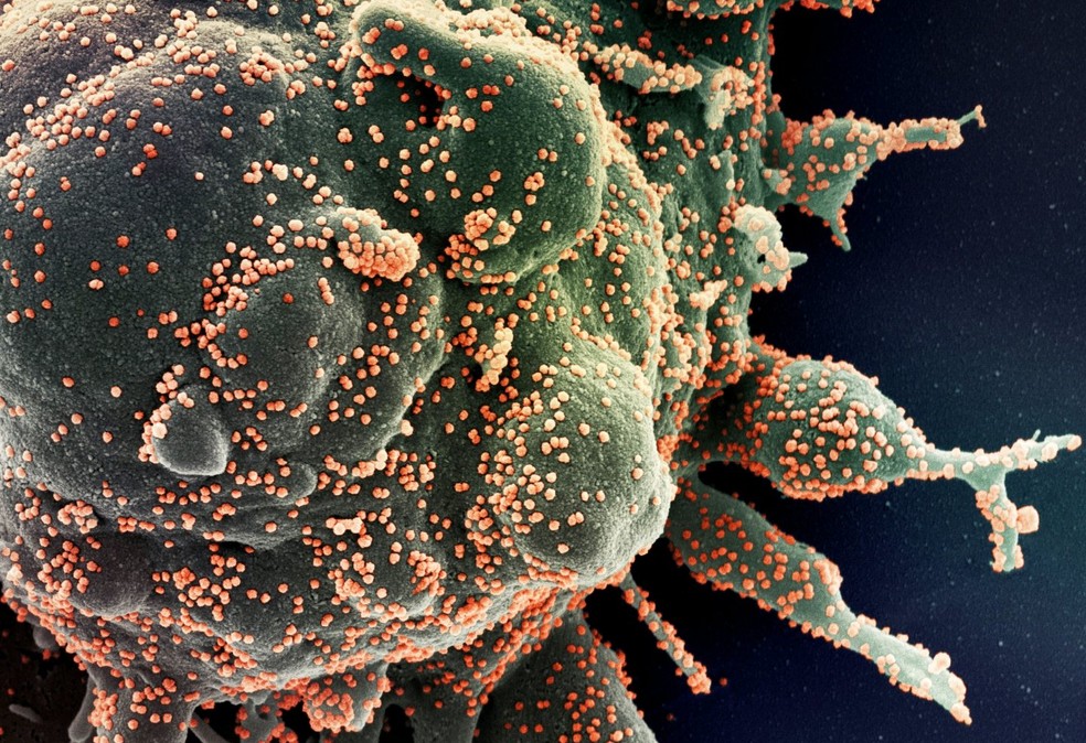 Foto microscópica mostra célula humana sendo infectada pelo Sars Cov-2, o novo coronavírus — Foto: NIAID via Nasa