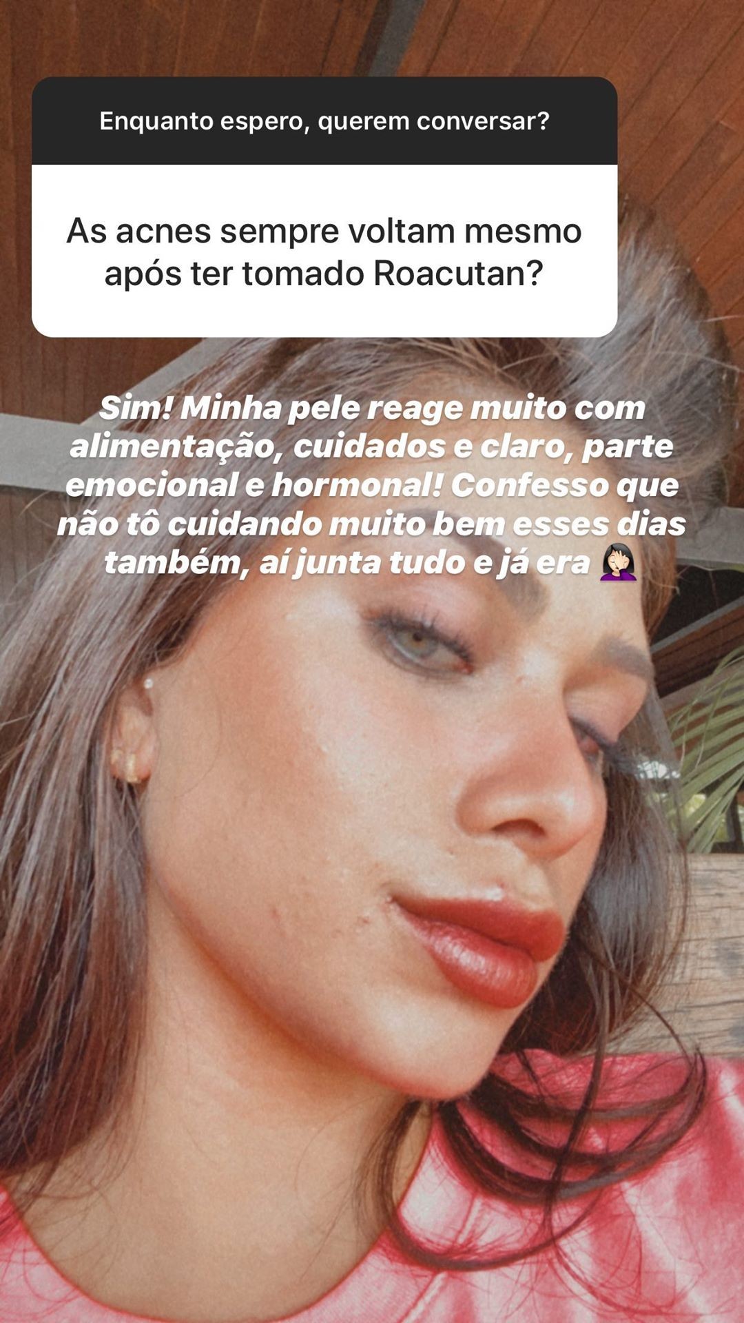 Flavia Pavanelli mostra batalha contra acne na web (Foto: Reprodução/Instagram)