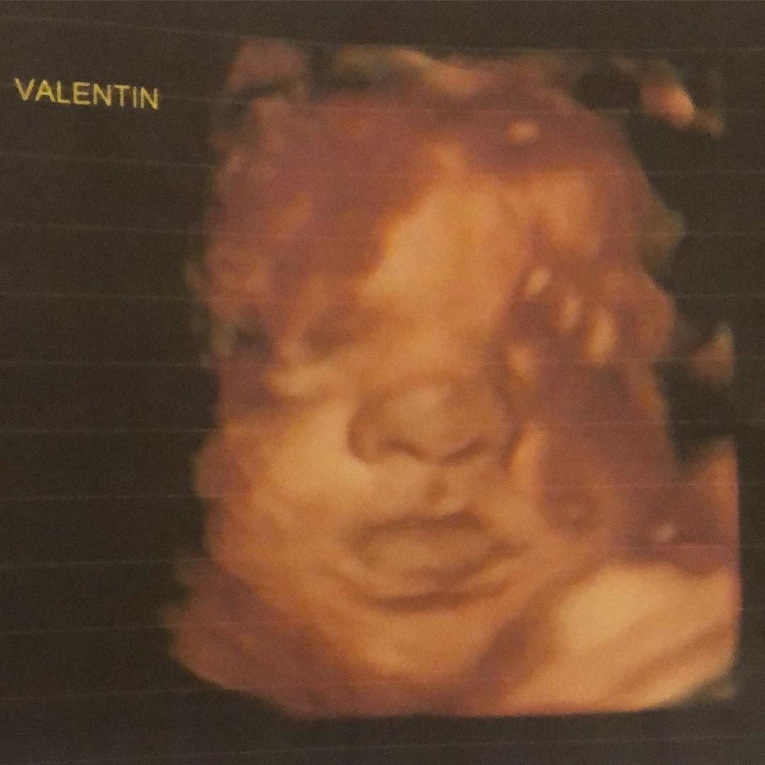 Carol Dantas mostra rostinho de seu bebê em ultrassom (Foto: Reprodução/ Instagram)