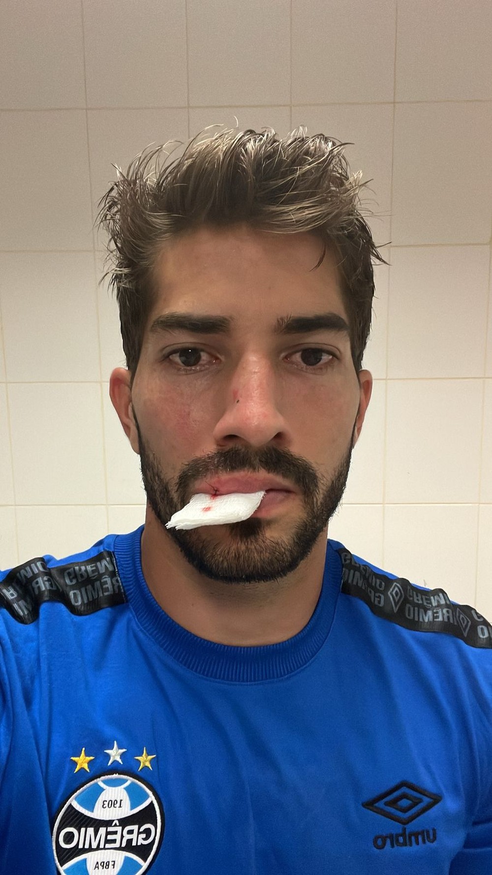 Súmula cita arremesso de celular em volante do Grêmio, e Inter pode ser denunciado no TJD-RS