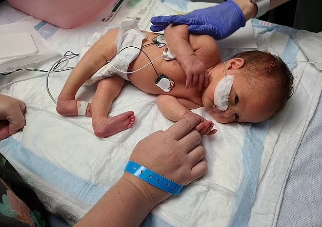 As perninhas da bebê ficavam rígidas, hiperextendidas (Foto: Reprodução/ Daily Mail)