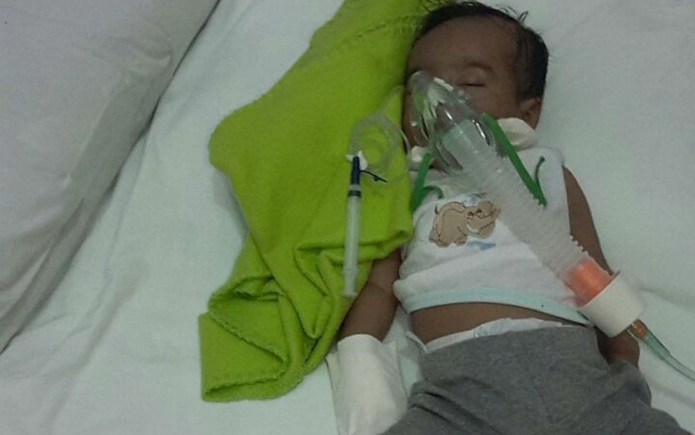 Bebê respira com ajuda de aparelhos (Foto: Arquivo pessoal)
