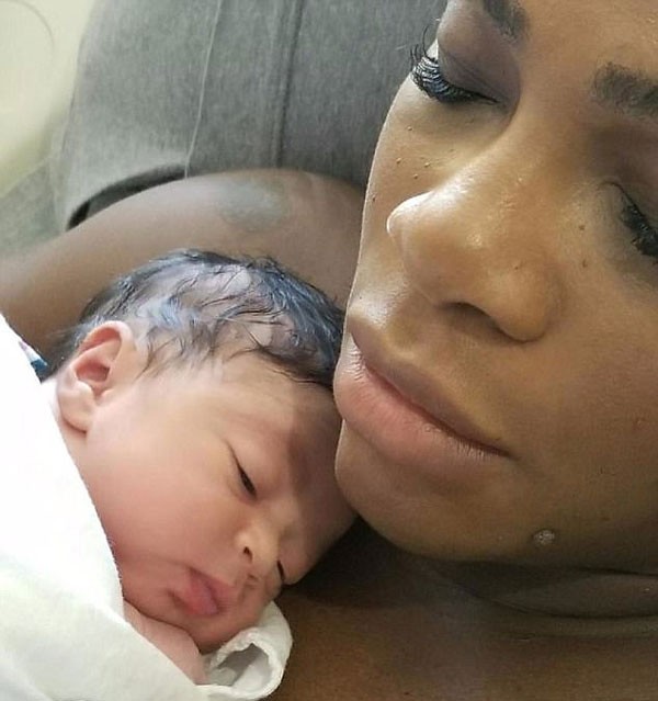 Alexis ao lado da mãe, Serena (Foto: Reprodução/Instagram)