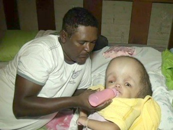 A doença de Maria Clara foi diagnosticada quando ela tinha dois meses (Foto: Nativa News)