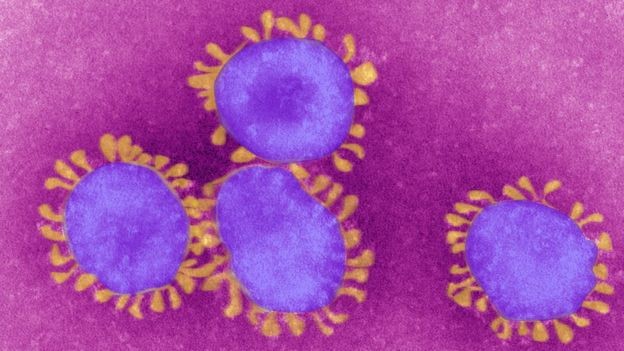 Diagnóstico do novo coronavírus inclui análise de laboratório, avaliação clínica e exame de imagem (Foto: BSIP via BBC)