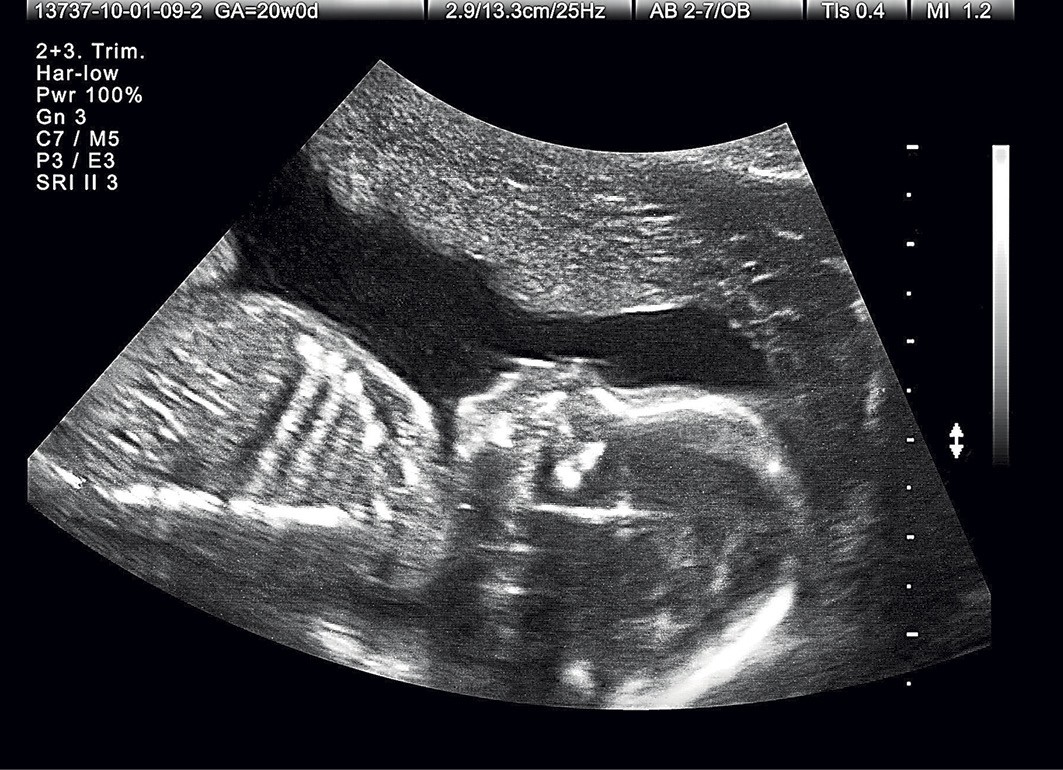 Pais também devem fazer acompanhamento médico durante o pré-natal - Revista Crescer | Saúde Pais também devem fazer acompanhamento médico durante o pré-natal - Revista Crescer | Saúde