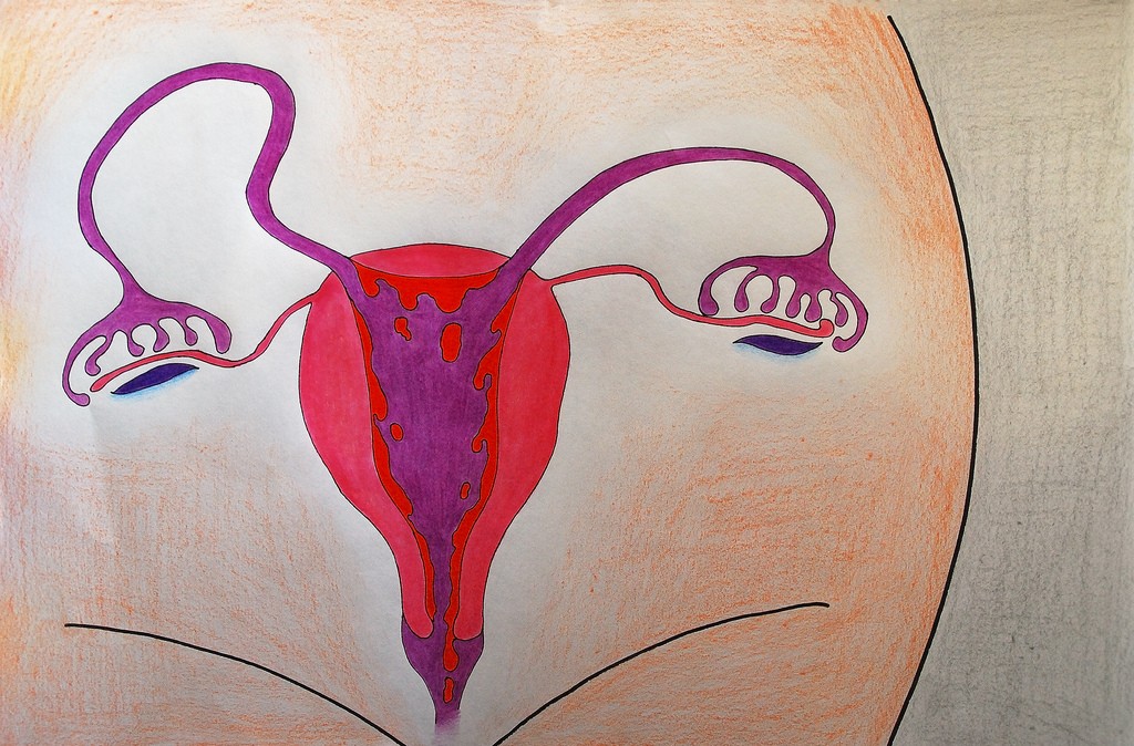 DISTÚRBIOS DA MENSTRUAÇÃO – Endoville