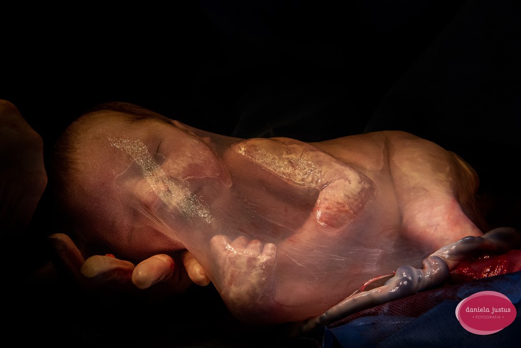 Bebê envolto a bolsa (Foto: Daniela Justus Fotografia (Brasil))