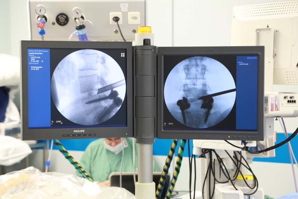 Câmera permite realização de cirurgia endoscópica da coluna na USP em Ribeirão Preto (SP) — Foto: Rafael Moraes/Divulgação