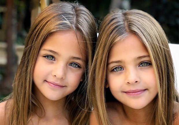 Irmãs De 7 Anos São Consideradas As Gêmeas Mais Lindas Do Mundo 98fm