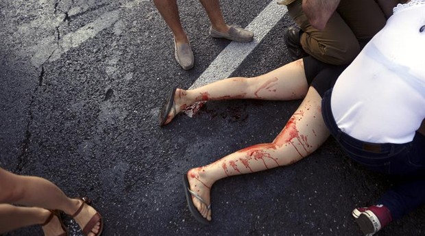 Mulher fica ferida após ataque ocorrido durante Parada Gay em Israel (Foto: Agência EFE)