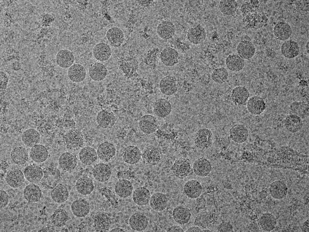  Imagem feita com crioscopia eletrônica do vírus da zika  (Foto: Universidade Purdue/Divulgação)