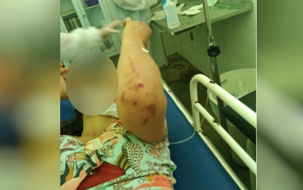 Mulher ficou com corpo cheio de hematomas após ser espancada pelo marido, em Posse, Goiás — Foto: Reprodução