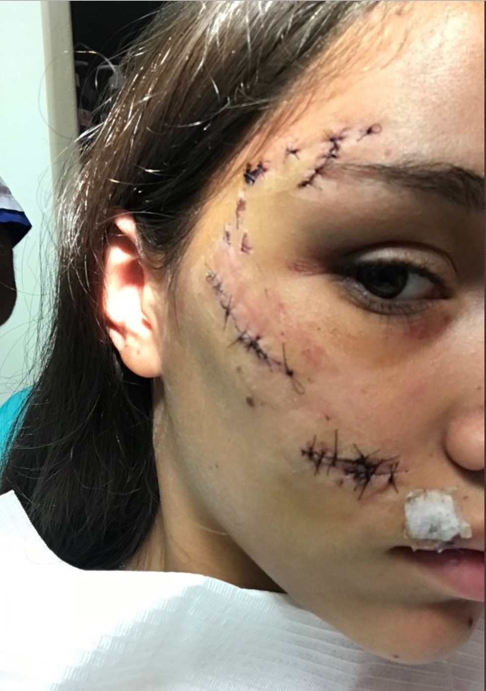 Jovem argentina mostra como ficou o rosto depois de mordida de cachorro — Foto: Reprodução/Twitter